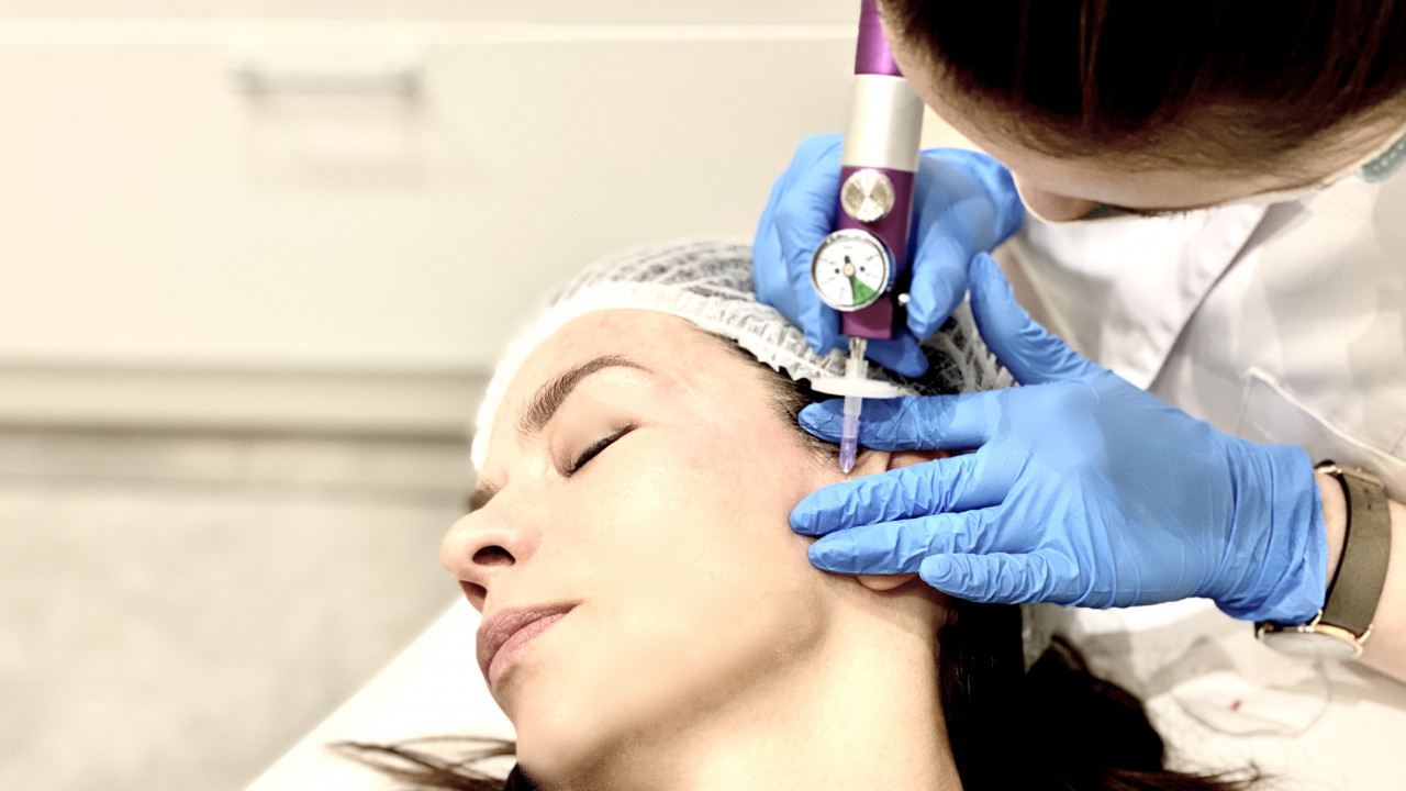 Karboksyteriapia na twarz - wskazania i korzyści